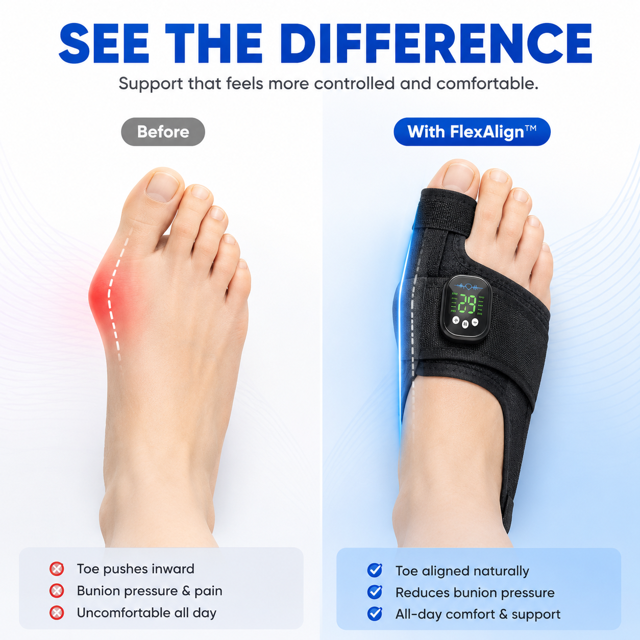 Bunion Ease FlexAlign™ Adjustable Bunion Relief & Toe Support Brace
