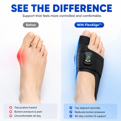 Bunion Ease FlexAlign™ Adjustable Bunion Relief & Toe Support Brace